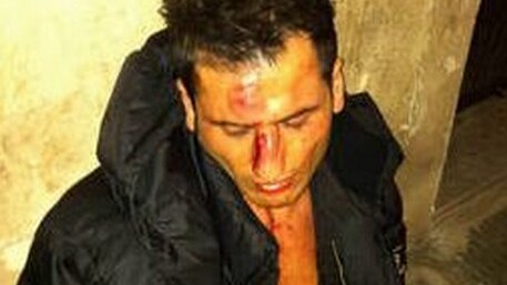 Mutu ed il cameriere aggredito