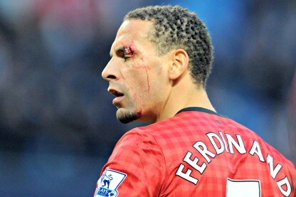 il giocatore colpito all'occhio dalla monetina