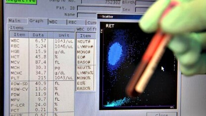 una provetta dell'antidoping