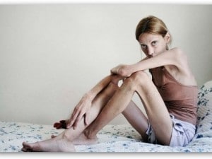 Talent scout alla ricerca di modelle in una clinica per ragazze anoressiche
