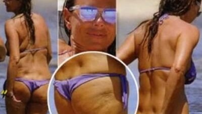 cellulite di Paola Perego