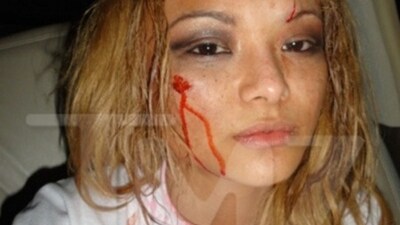 tila tequila dopo aggressione