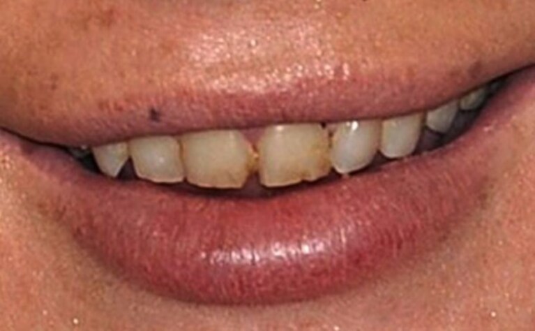 lindsay lohan