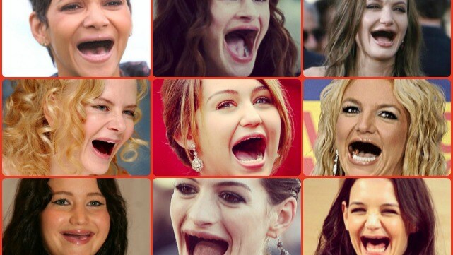 Avete mai pensato all'effetto che farebbe la vostra attrice preferita se non avesse più i denti?