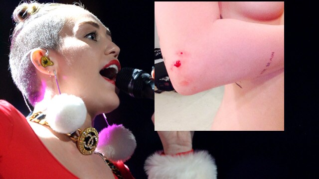 miley-cirus-ferita