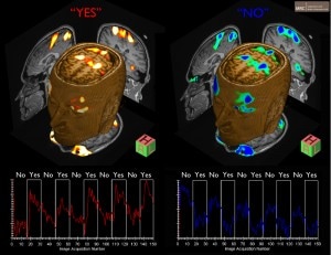 neuroimaging