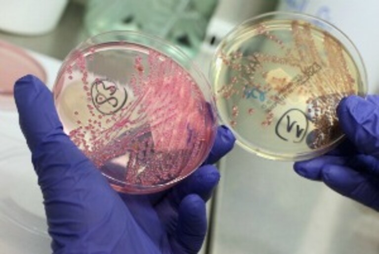 E.coli