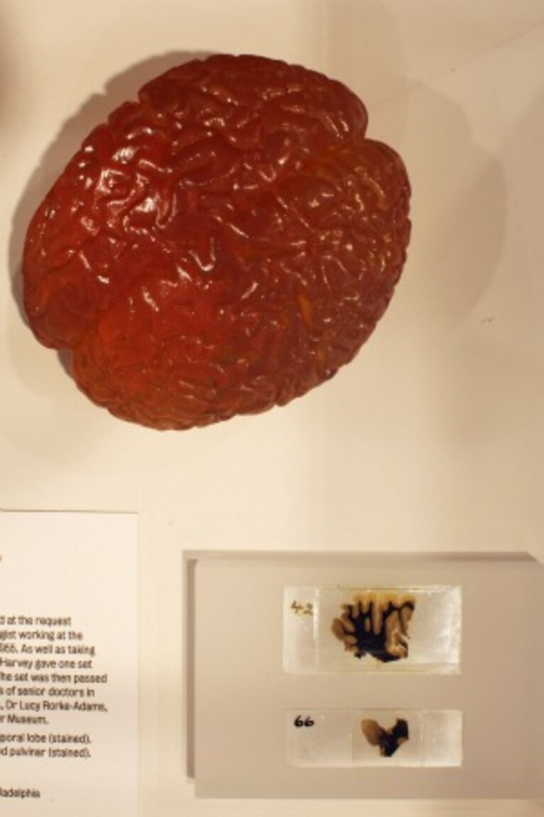 il cervello di Einstein