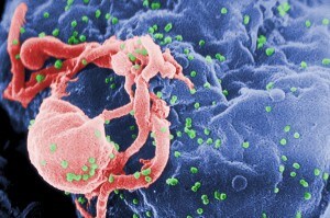 Un virus dell’HIV attacca un linfocita T.