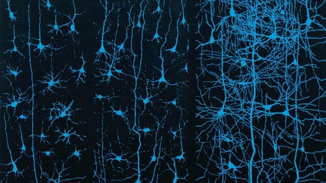 Neuroni dolore
