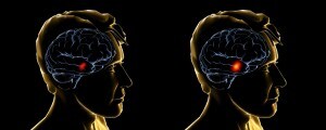 neuroimaging1