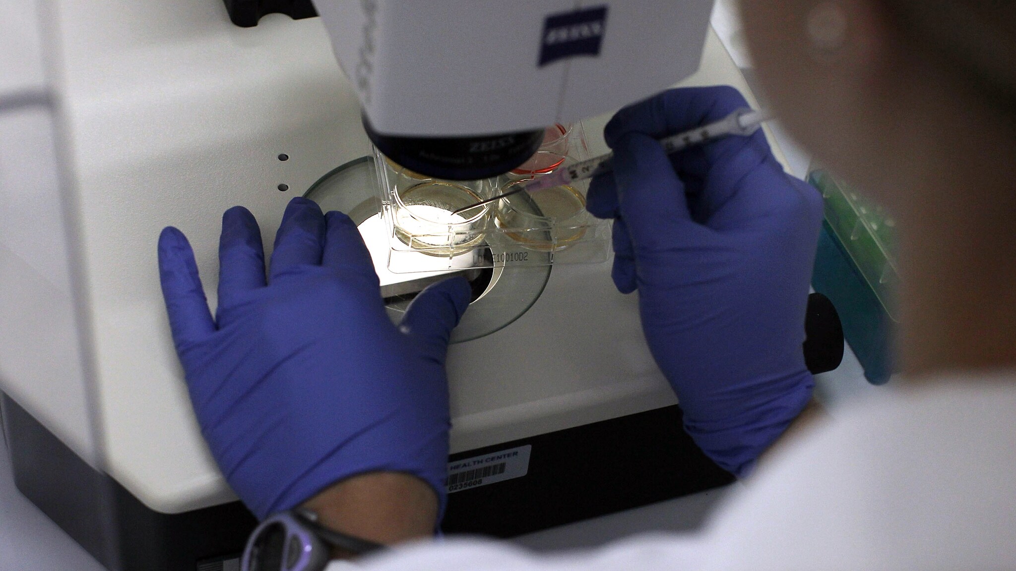 Uno studio tutto italiano ha evidenziato come il trapianto di alcune cellule staminali potrebbe riparare il cervello dal danno post traumatico.