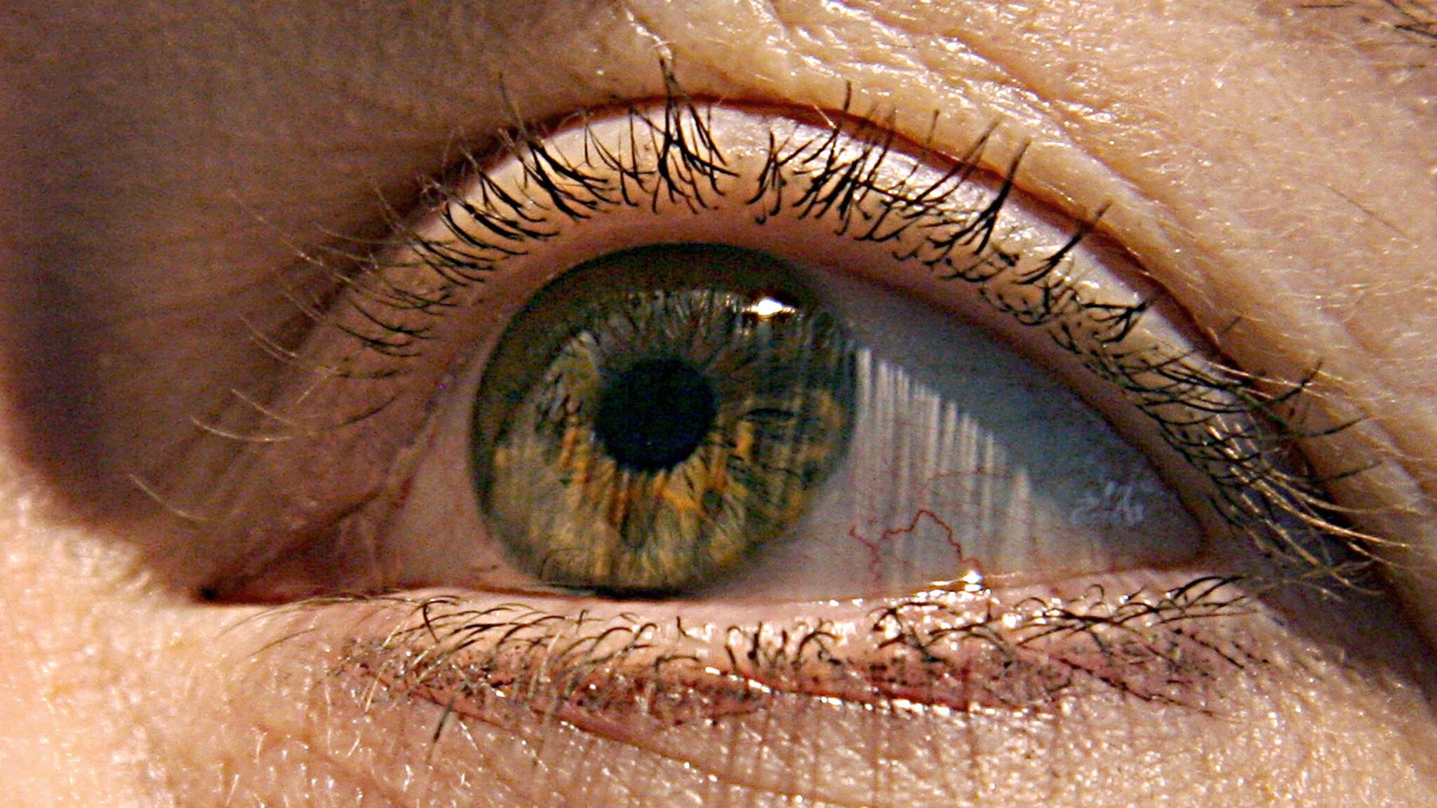 Una protesi collegata ad una microcamera: così chi è affetto da malattie degenerative della retina potrebbe tornare a vedere.