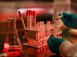 Polemiche nel mondo scientifico per la pubblicazione di uno studio, alcuni ricercatori olandesi avrebbero prodotto in laboratorio una variante ad altissima contagiosità del virus H5N1, meglio noto come quello dell'influenza aviaria.
