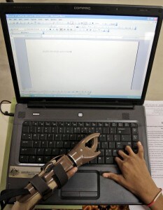 protesi_mano