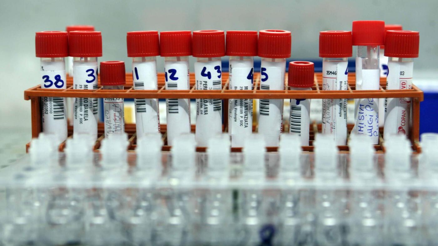 Un potente anticorpo è in grado di proteggere l'organismo da tutti i virus influenzali conosciuti, partendo dall'influenza del 1918, lo rivela uno studio condotto dai ricercatori del San Raffaele.