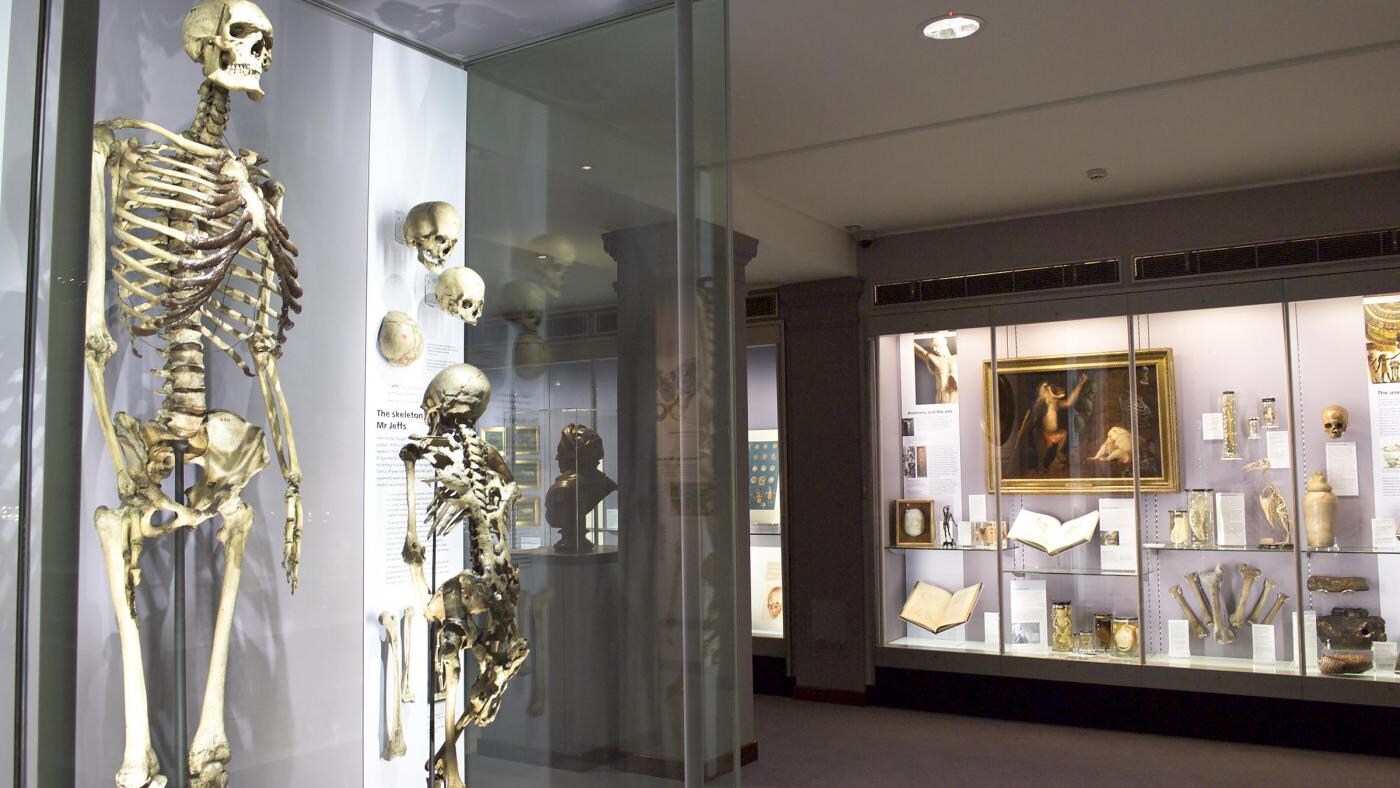 Con la sua altezza superiore a due metri e mezzo, Charles Byrne, nel XIX secolo, fu un fenomeno da baraccone. A tutt'oggi attorno alle sue spoglie, custodite in un museo, è in atto una controversia tra chi sostiene che quel corpo da freak debba restare a disposizione della scienza e chi vorrebbe dare al gigante irlandese la sepoltura che lo sventurato uomo desiderò quando era ancora in vita.