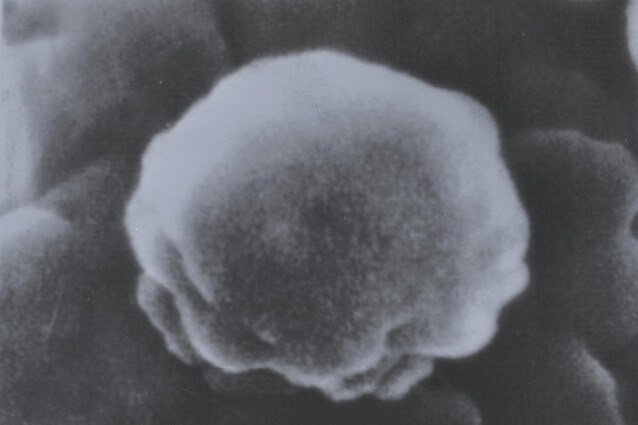 Il virologo statunitense Robert Gallo, che nel 1983 fu tra gli scopritori del virus HIV, annuncia l'arrivo di un vaccino anti AIDS nel giro di pochi anni, una speranza per il futuro che tutti aspettano.
