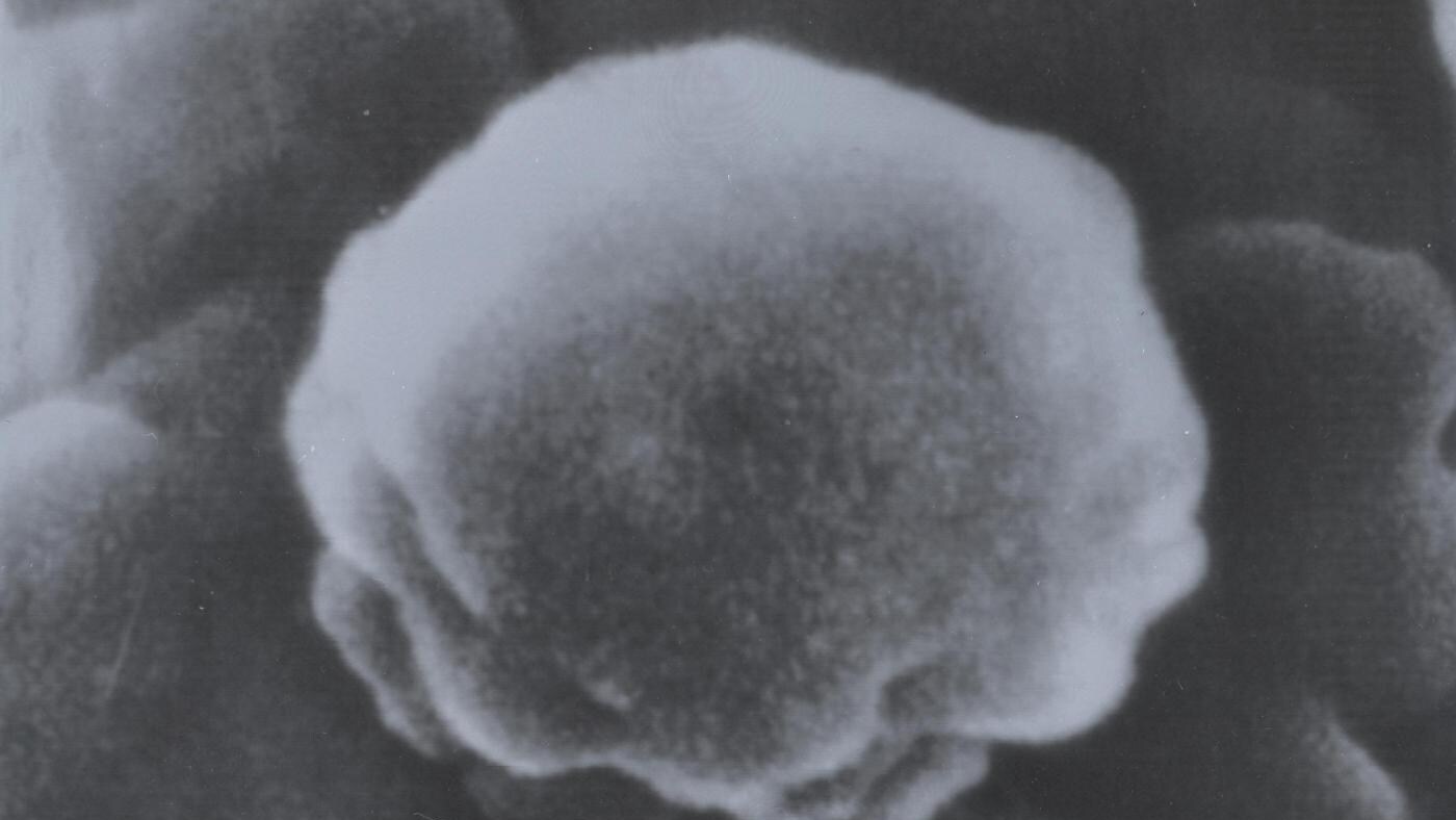 Il virologo statunitense Robert Gallo, che nel 1983 fu tra gli scopritori del virus HIV, annuncia l'arrivo di un vaccino anti AIDS nel giro di pochi anni, una speranza per il futuro che tutti aspettano.