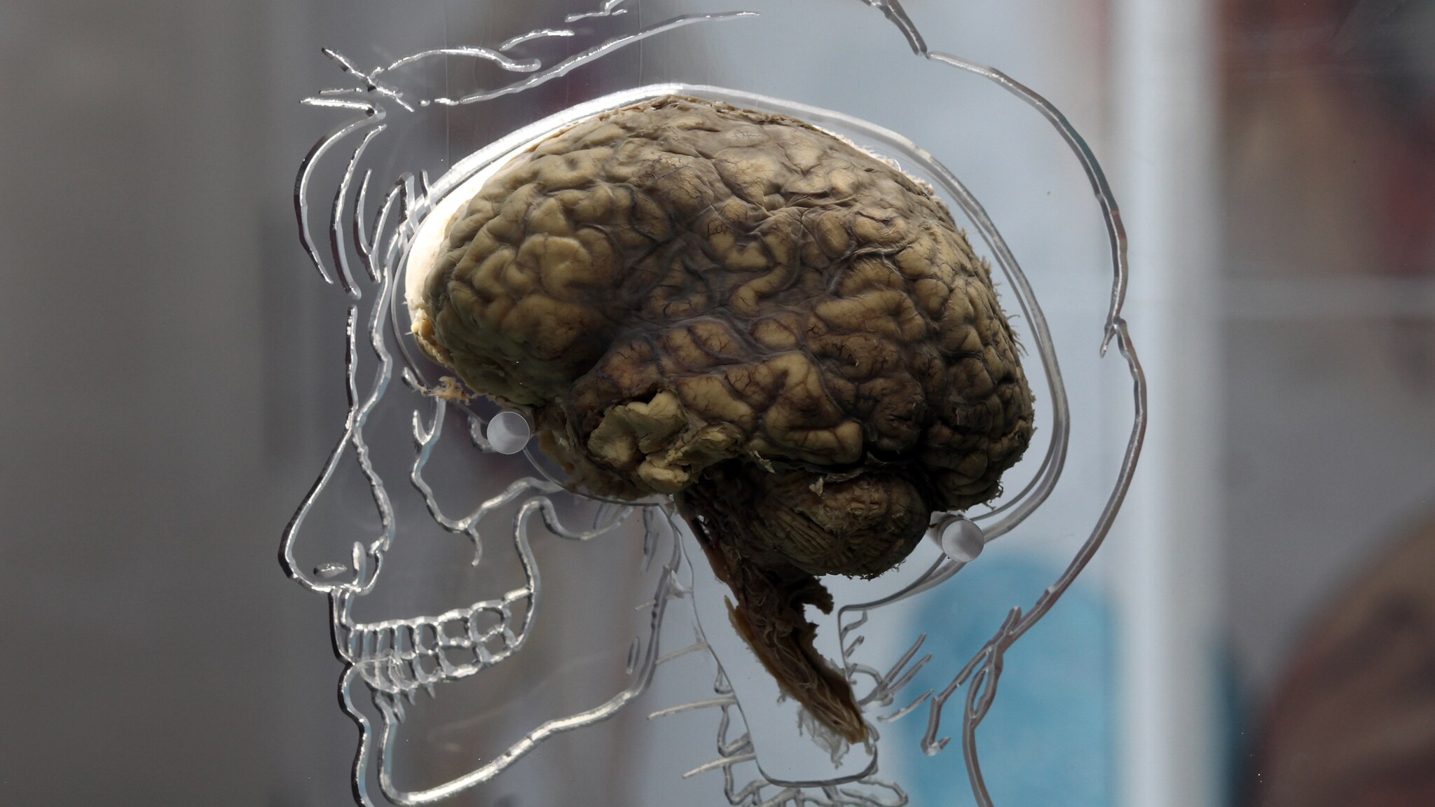La proteina che regola funzioni cerebrali indispensabili quali memoria ed apprendimento diminuisce fisiologicamente con il trascorrere degli anni, ma la sua funzione può essere riattivata, in età avanzata, attraverso la semplice restrizione calorica.