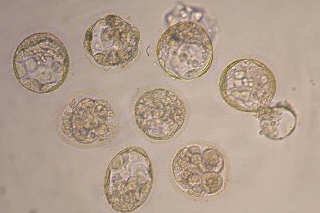 L ambizioso progetto porta la firma di alcuni ricercatori britannici, l'obiettivo, entro tre anni, è quello di sperimentare una tecnica di fecondazione assistita in cui il corredo genetico del nascituro viene integrato con il DNA di una seconda donna. Scopo, evitare la trasmissione di malattie genetiche trasmesse per via materna.