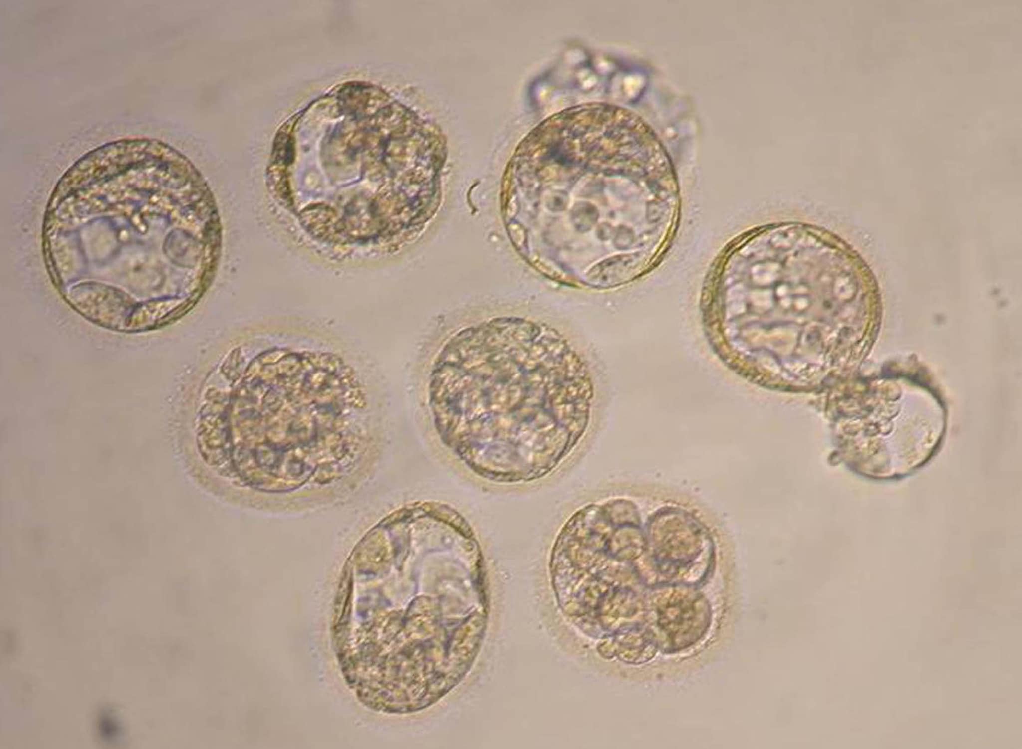 L ambizioso progetto porta la firma di alcuni ricercatori britannici, l'obiettivo, entro tre anni, è quello di sperimentare una tecnica di fecondazione assistita in cui il corredo genetico del nascituro viene integrato con il DNA di una seconda donna. Scopo, evitare la trasmissione di malattie genetiche trasmesse per via materna.
