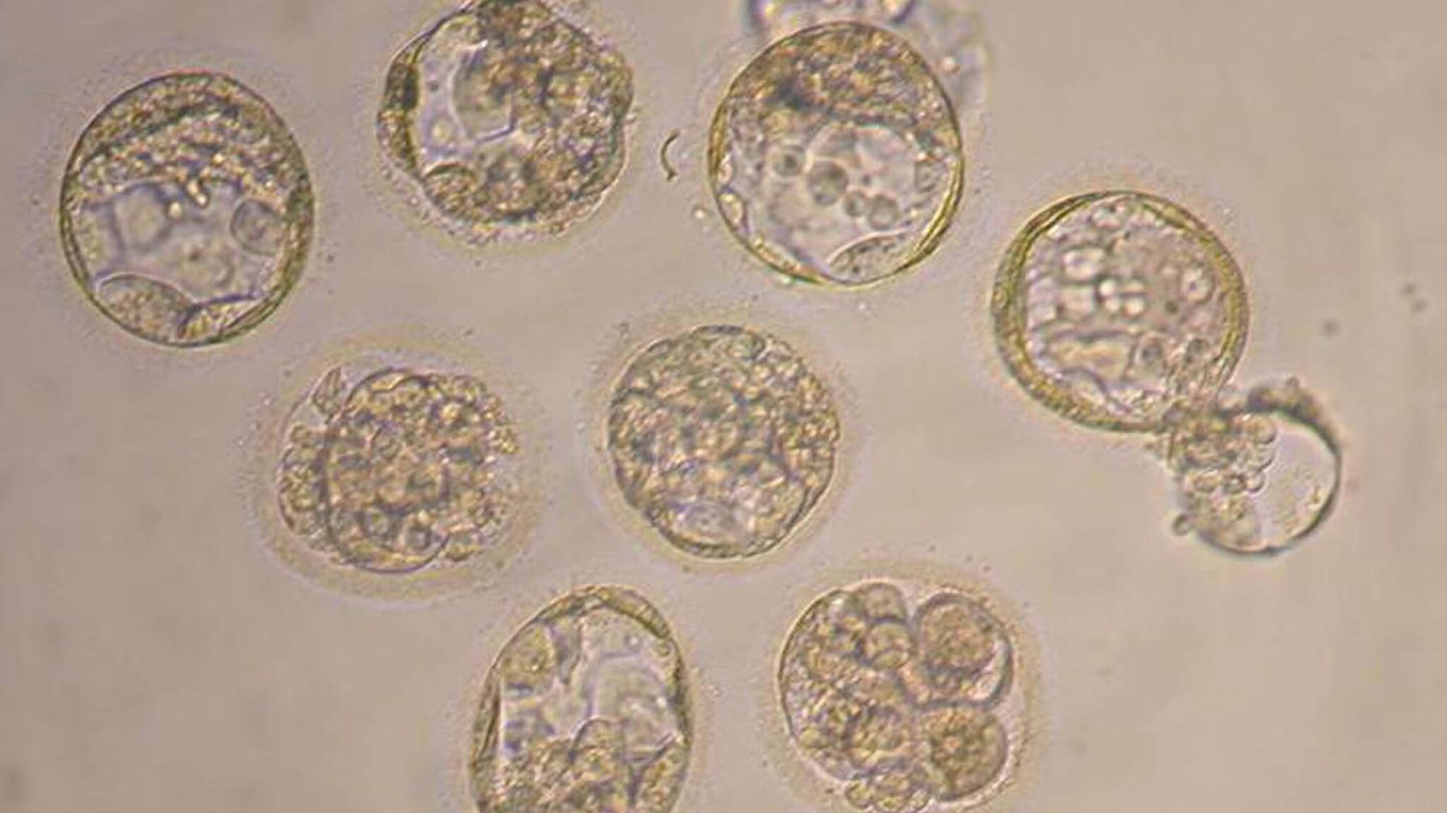 L ambizioso progetto porta la firma di alcuni ricercatori britannici, l'obiettivo, entro tre anni, è quello di sperimentare una tecnica di fecondazione assistita in cui il corredo genetico del nascituro viene integrato con il DNA di una seconda donna. Scopo, evitare la trasmissione di malattie genetiche trasmesse per via materna.