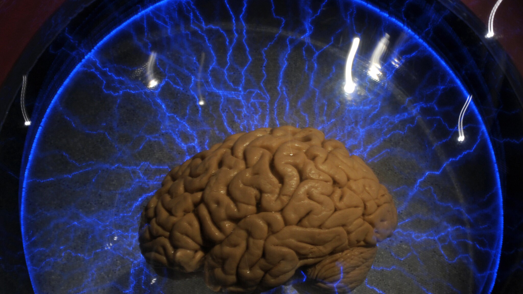 Parlare di terapia prodigiosa è ancora prematuro, tuttavia alcuni ricercatori hanno dimostrato che una stimolazione ottenuta tramite elettrodi impiantati nel cervello può avere effetti positivi a lungo termine su pazienti affetti da depressione e disturbo bipolare.