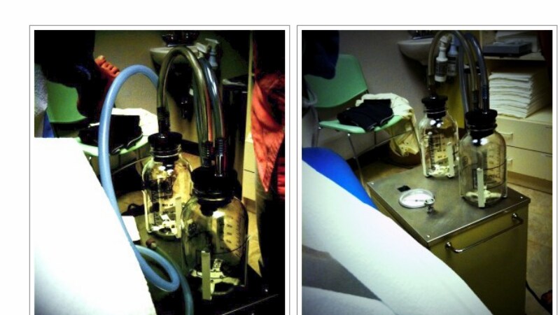 Una fotografa statunitense ha deciso di abortire e nel sottoporsi all’intervento ha preso il suo cellulare e ha scattato quattro foto. Immagini diverse da quelle solitamente mostrate dai movimenti anti-abortisti, necessarie per documentare un’altra realtà.