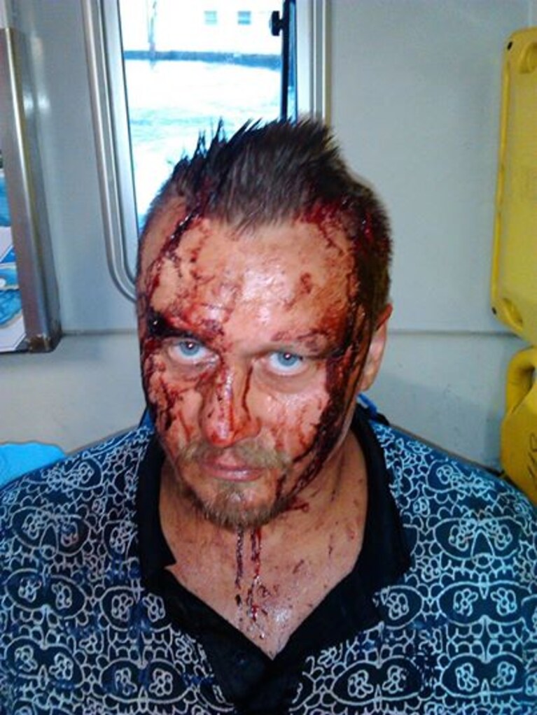 La foto del pestaggio di Oleg Vorotnikov