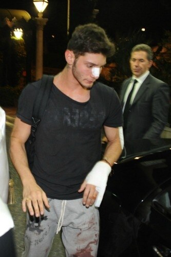 Stefano De Martino dopo l\'incidente