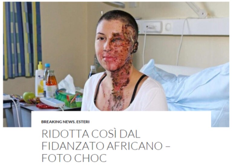 Immagine