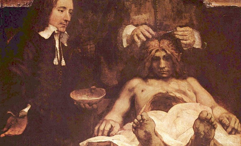 Rembrandt, "Lezione di anatomia del dottor Deyman" (1656), Ermitage Museum, Amsterdam