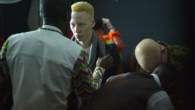 Albino in Nigeria, Africa (Getty).