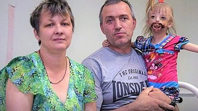 Darina Shpengler, 3 anni, con i suoi genitori.