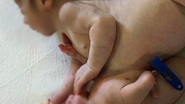 Immagine