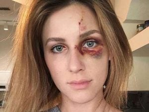 Melissa Gentz, 22 anni (Instagram).