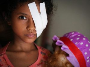 Razan, una bimba yemenita di 8 anni ferita ad un occhio durante un bombardamento a Hodeida (Save the Children)