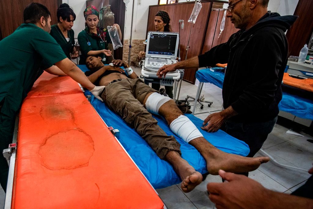 Un ferito nell’ospedale di Tal Tamer, nel nord–est della Siria (Gettyimages)