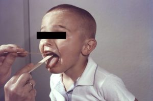 Un bambino sottoposto a tampone faringeo. Credit: CDC (Centers for Disease Control and Prevention)– Public Health Image Library (PHIL)