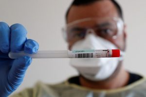 In Emilia-Romagna test fai da te per inizio e fine quarantena