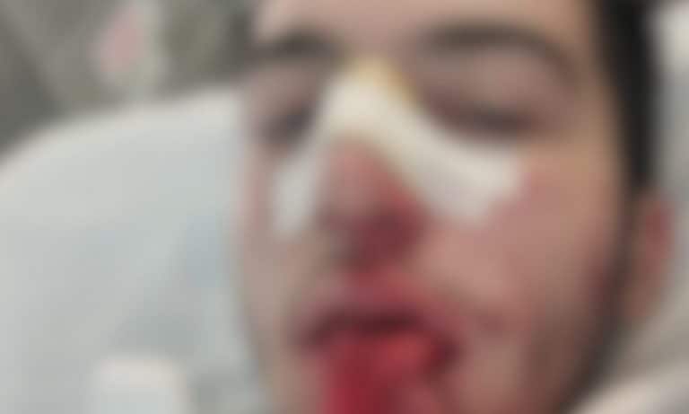 La vittima del pestaggio