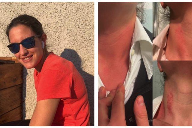 Quasi strozzata da paziente in ambulatorio, la rabbia della dottoressa: “Cambierò mestiere”