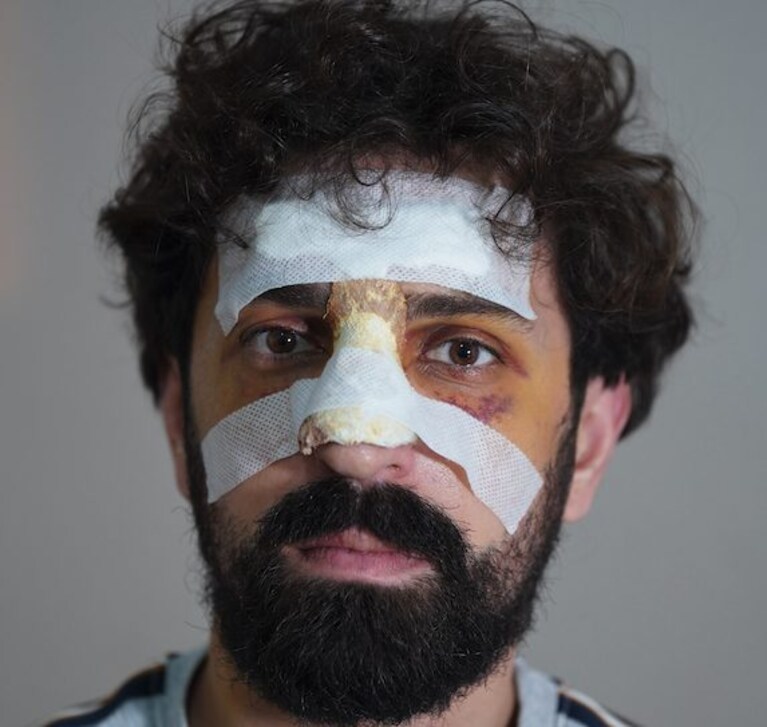 Aleksandre “Lesko” Keshelashvili.