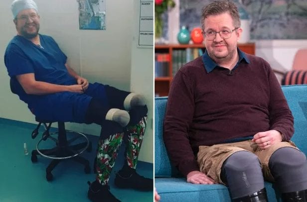 "Ho perso le gambe per sepsi", ma il chirurgo inglese è accusato di aver mentito per truffare assicurazione