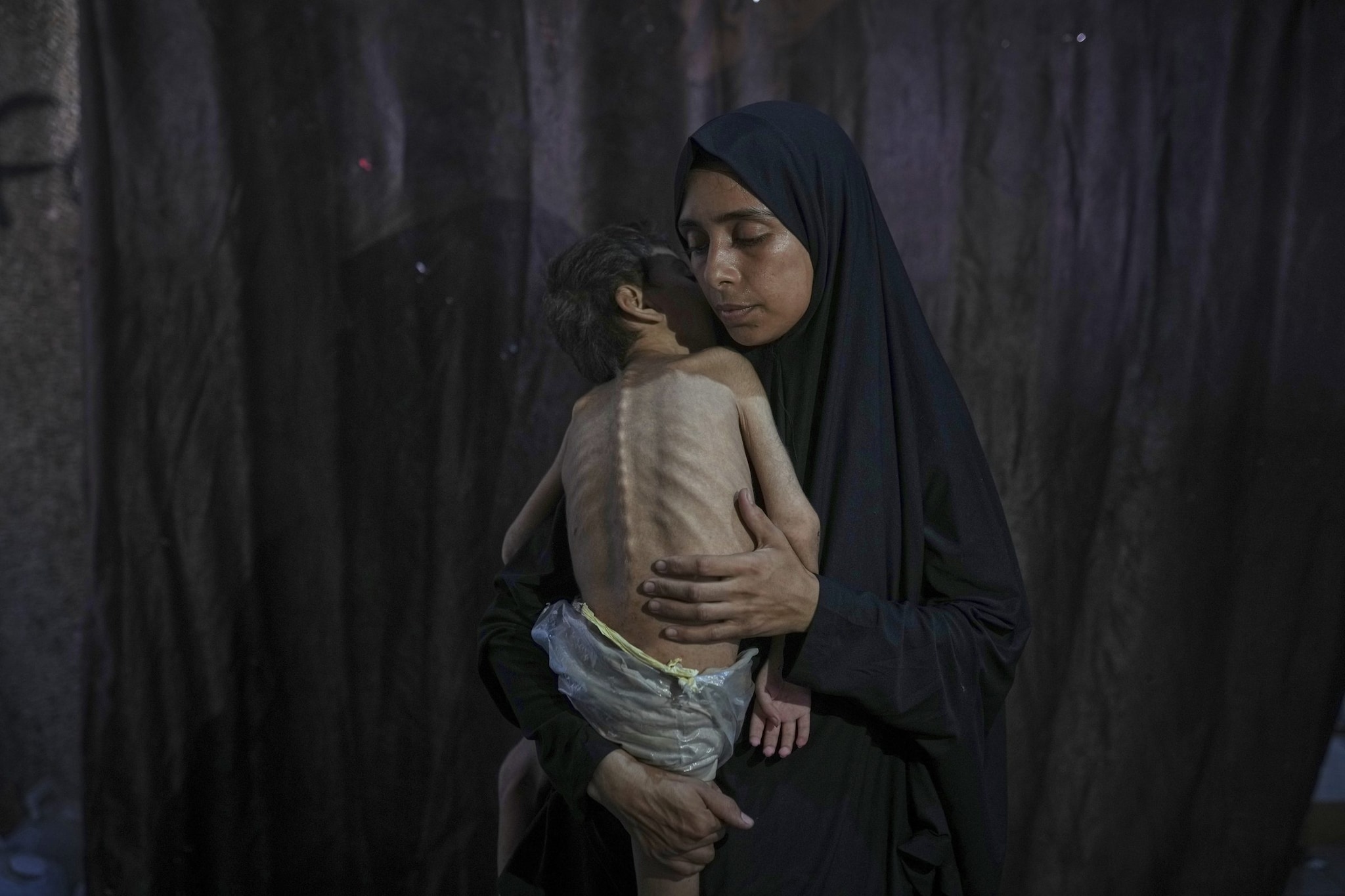 Secondo l'Onu a Gaza 300mila bambini rischiano di morire per malnutrizione acuta