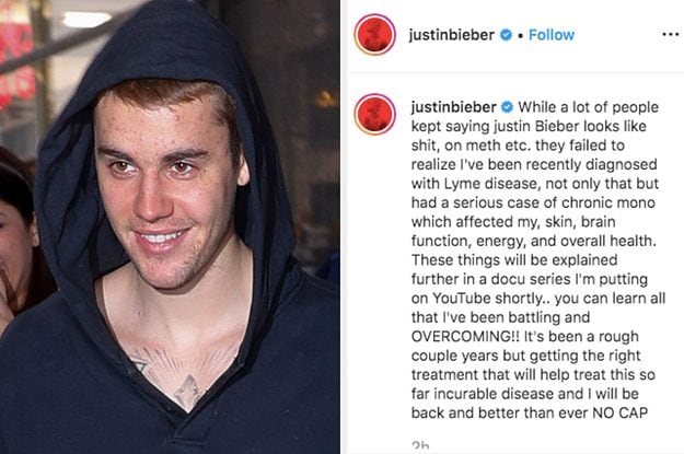 Post di Justin Bieber, poi rimosso