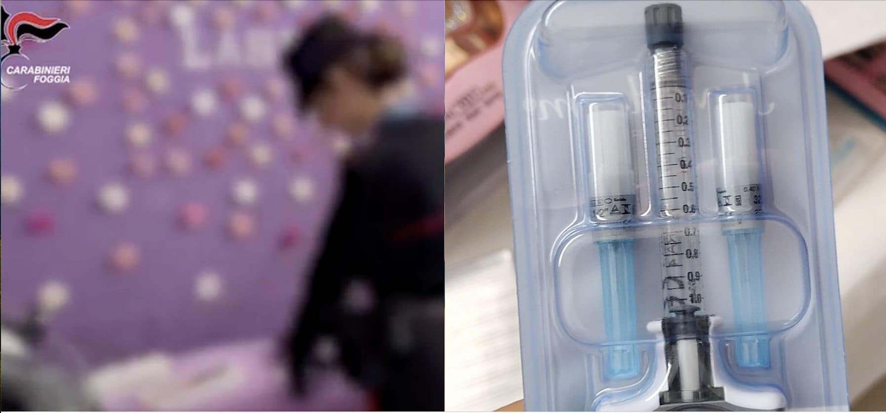 Centro estetico chiuso a Lucera: trattamenti con botulismo e filler, incastrati dalle pubblicità su Instagram