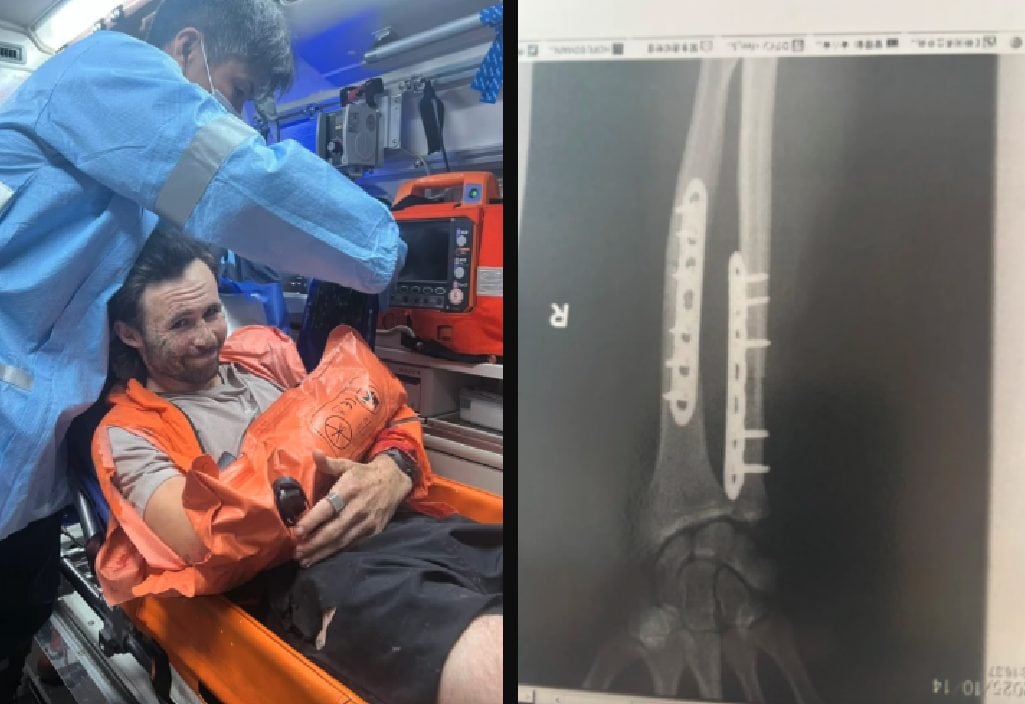 "Con un solo morso il mio braccio era finito". Lotta e sopravvive contro un orso in Giappone