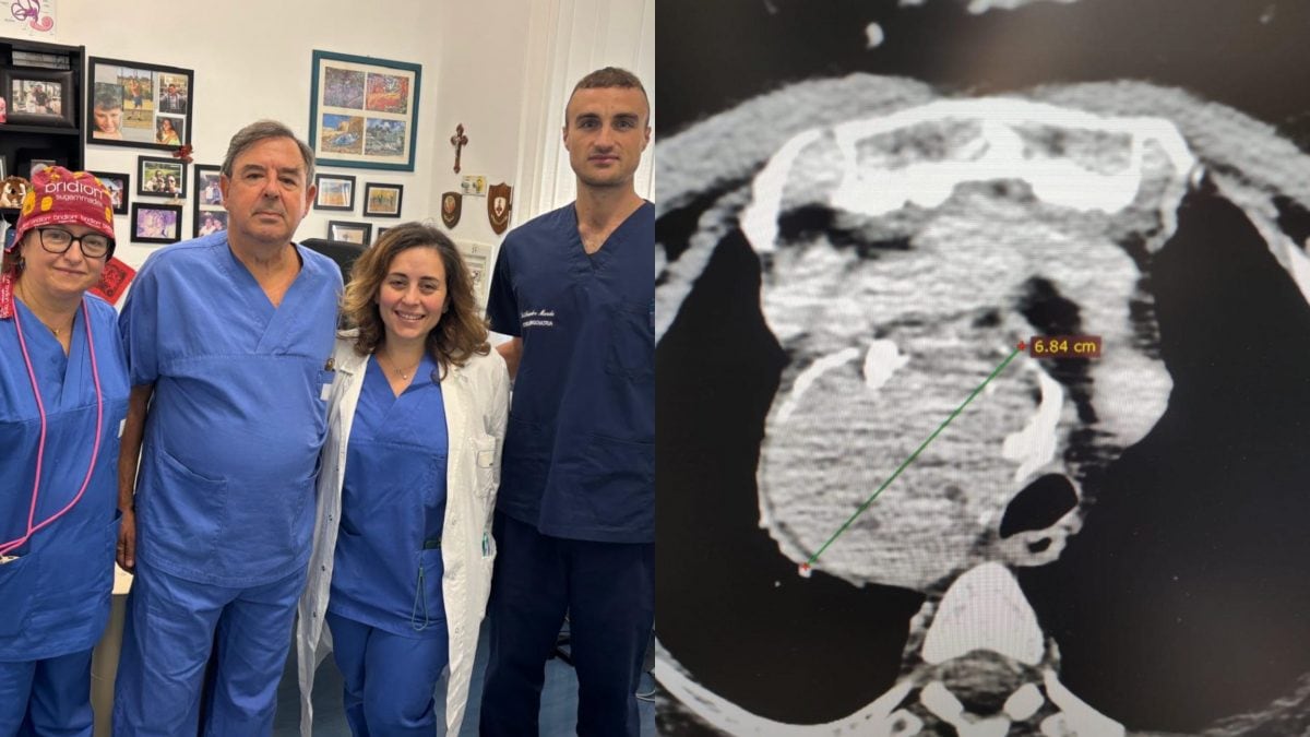 I medici che hanno realizzato l’operazione a Bari.